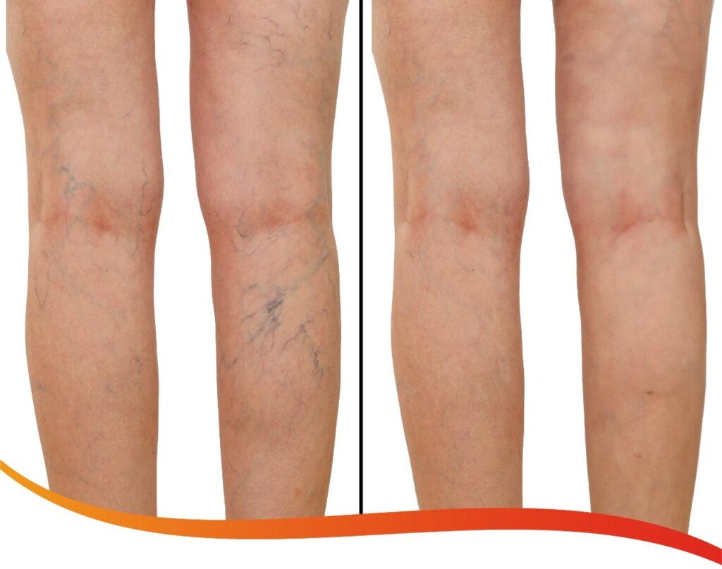 💚 Problemas Circulatorios y Articulares: síntomas, causas y solución con regeneración celular